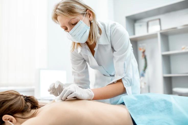 Woman having acupuncture